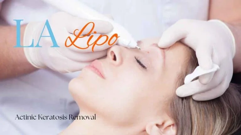 Woman receiving Actinic Keratosis Removal Treatment St Ives