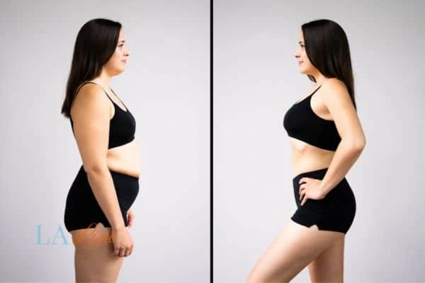 LA-EMS Body Sculpting St Ives results before and after of womans results on body toning.
