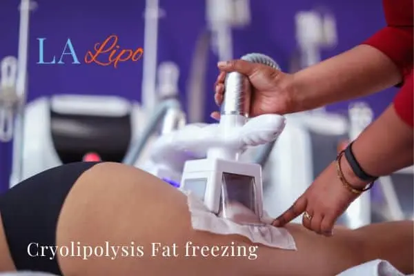 women getting fat freezing St Ives