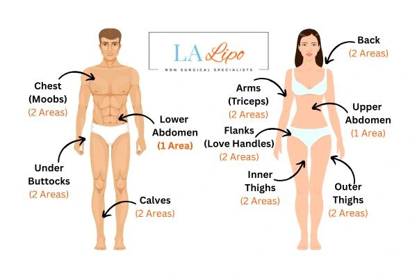 LA LIPO Cryolipolysis Areas St Ives