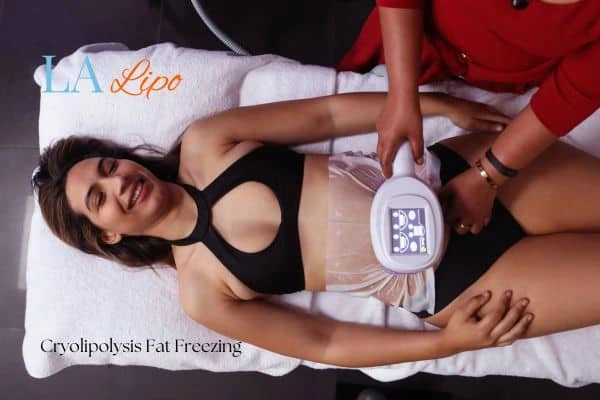 woman getting cryolipolysis St Ives