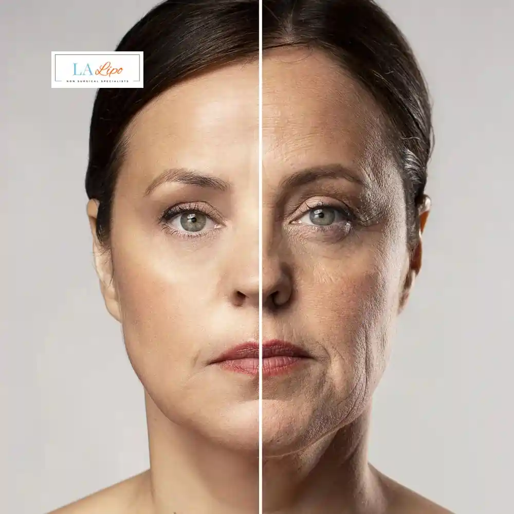 How Can You Tell If Non-Surgical Skin Tightening Is Right for You St Ives?