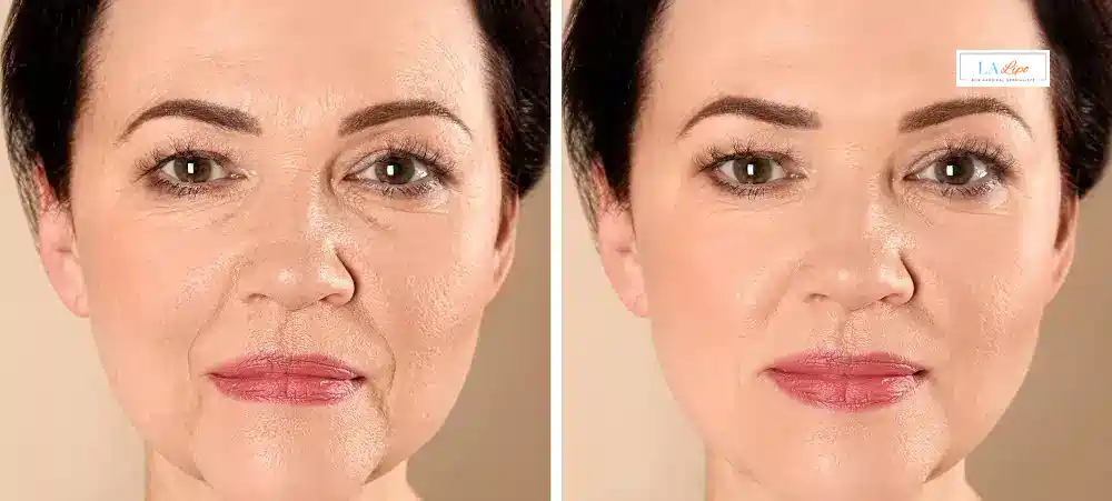 How Long Does It Take to See Results and How Long Do They Last St Ives?