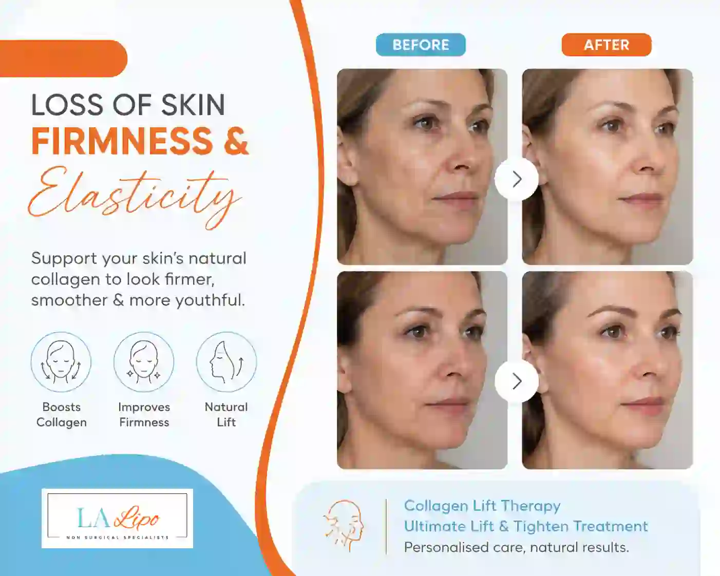 Sign #7: Loss of Skin Firmness and Elasticity St Ives