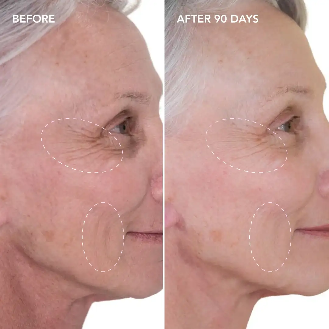 When will you see results St Ives